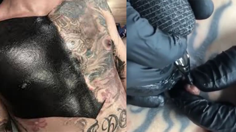 Areola tattoo